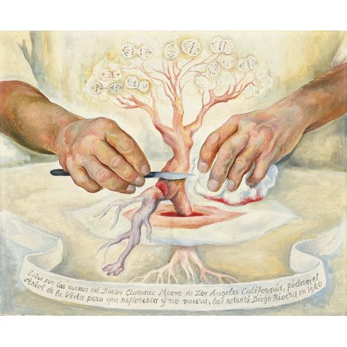 Diego Rivera, Dr. Moore'un Elleri Diego Rivera, Dr. Moore'un Elleri