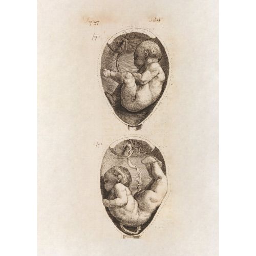 George Stubbs, Yeni Bir Ebelik Sistemine Yönelik Bir Deneme